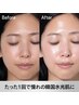 リピート【韓国最先端トロイアルケ】常に水光肌を　VVSダイヤモンドピール