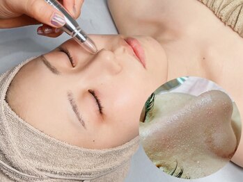 ジョアアンジェ 京橋店(joie ange)の写真/毛穴・肌質管理,改善なら当店へ！紫外線,美白ケアもお任せ下さい【溶ける角栓毛穴洗浄/ララピール】導入店