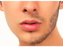 アムプラス(AM+)/メンズ脱毛