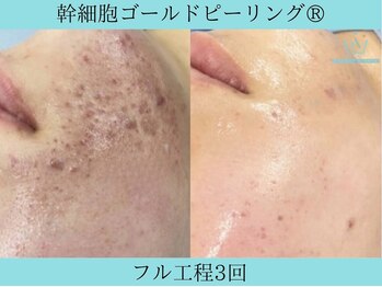 リメイク 広尾(REMAKE)/