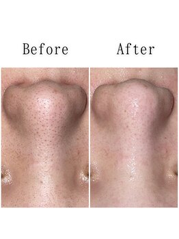 グラシア(gracia)/シミ・毛穴ケア専門店gracia