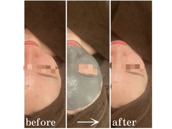 エングロー 錦糸町店(Englow)/【絶対美白】復元パック