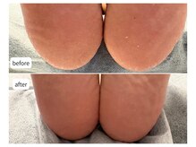 カシェット(Cachette)/40代女性◎足裏角質ケア90分