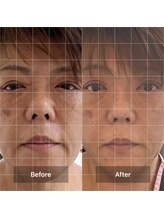 プラスボーテ 幡ヶ谷(plus beaute)/肌の気になるところに/北参道