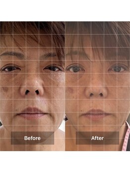 プラスボーテ 幡ヶ谷(plus beaute)/肌の気になるところに/北参道