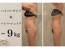 サロン ド ソワ(Salon de Soie)/ハイパーナイフ×シェイプ