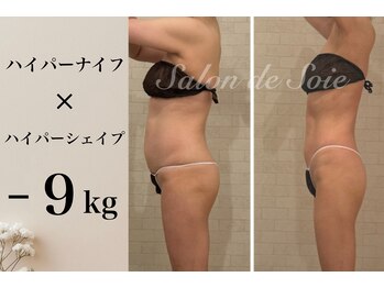 サロン ド ソワ(Salon de Soie)/ハイパーナイフ×シェイプ