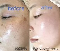 徳島美容サロン