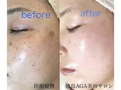 徳島美容サロンの写真