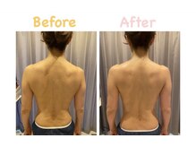 クレビア 麻布十番(CREBIA)/上半身のむくみをスッキリ！！