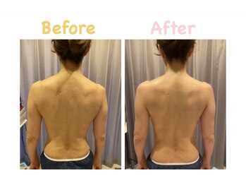 クレビア 麻布十番(CREBIA)/上半身のむくみをスッキリ！！