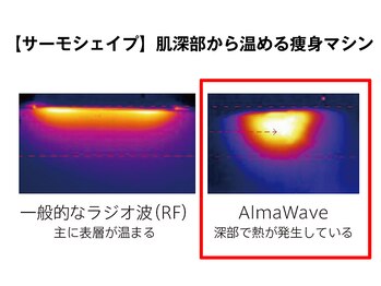 ビューティーリバース 東戸塚店/サーモシェイプ