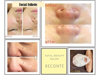 レコンテ 大通店(RECONTE)