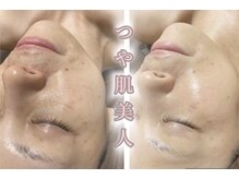 サロンデュヒャーク 志木駅前店(salon du ひゃーく)/お肌のお悩み解決に自信アリ！