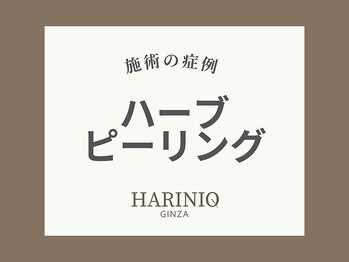 ハリニーク 銀座店(HARINIQ)/ハーブピーリングによる施術変化
