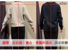 リベスト(RE:BEST)/骨格矯正/猫背/左右差/バランス