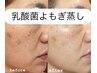 【乳酸菌よもぎ蒸し】乳酸菌＋独自ブレンド　水分たっぷり潤艶肌　通常6,000