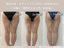 エヌズ(Ns)/サブスク会員様