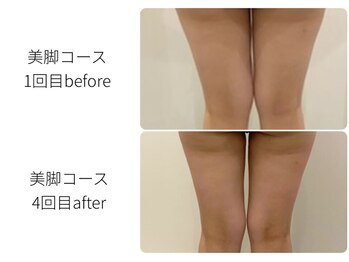 ほねつぎ一休さん 宇品店/すっきり美脚コース