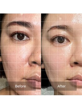 プラスボーテ 幡ヶ谷(plus beaute)/肌が跳ね上がる?!北参道/原宿