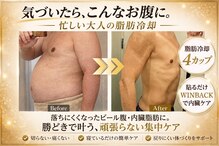 サロンドモモ(SALON de MOMO)