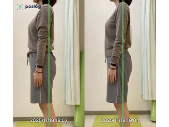 ベル通り整骨院の写真/動画撮影で姿勢と動きのチェック!ボキボキしない施術で姿勢改善をサポートします