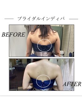 ファミーユ 新宿店/【ブライダルインディバ】