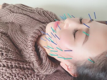 アオイ(aoi)の写真/美容鍼で素肌美人に！初めての方も歓迎♪お客様一人ひとりに合わせて根本改善！ほうれい線、たるみケアも◎