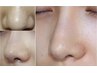 毛穴大掃除!！化粧肌・ニキビ性肌にお薦め!　Unclogging pores　60分　￥4980