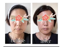 エンカフェサロン(en-cafe salon)の雰囲気(艶々な綺麗なお肌◆光フェイシャル◆一回でも効果抜群◆)