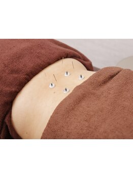 鍼灸施術を受けたい