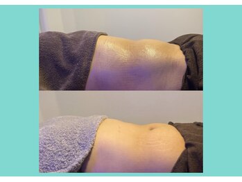 サロンビオーナ(SALON Biona)/腸もみ