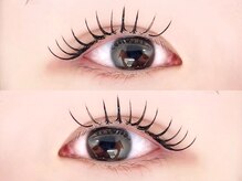 リステン アネックス(Lis 10 Annex)