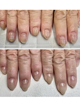 フロレネア(Florenea)/自爪育成 クリア仕上げ