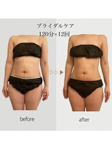 ファミーユ 名古屋店/【ブライダルケア】お腹周り