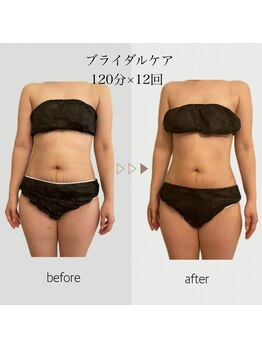 ファミーユ 名古屋店/【ブライダルケア】お腹周り