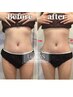 【腸活と美くびれライン】最上位インディバorハイパーナイフEX♪部分集中60分