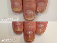 キラネイル アンド アイラッシュ by World Beauty(KIRA)/新潟自爪育成　フィルイン　