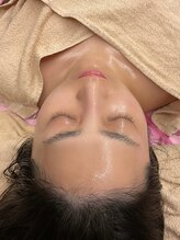 クラヴェル(Clavel)/30代後半セルマン症例