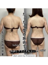 エヌボーテ(N. beaute)/before→after 1回目