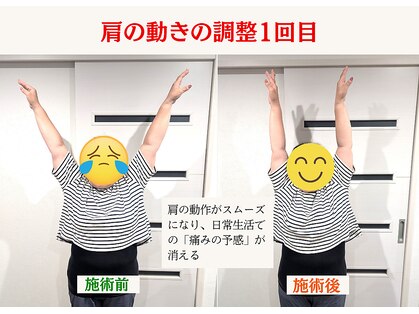サウレ(Saule)の写真