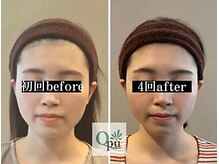 キュープ 鹿児島伊集院店(Qpu)/