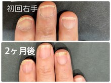 ネイルデュースの雰囲気(元育爪梅田店スタッフによる丁寧カウンセリングと施術)