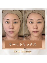 リム ビューティー(RYM BEAUTY)/サーマトリックス