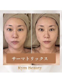 リム ビューティー(RYM BEAUTY)/サーマトリックス