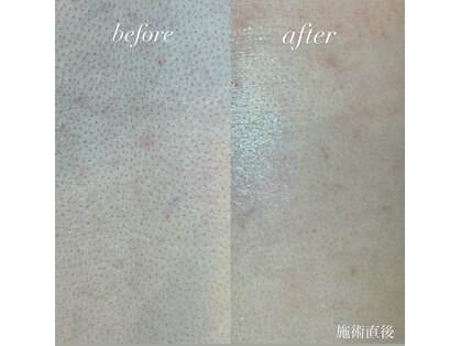 美創館フレッシュ(Fresh)の写真
