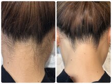 サロンド ソラ(Salon de SoLA)/卒業シーズン！うなじミックス