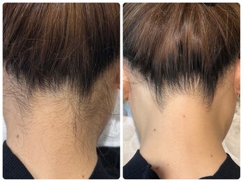 サロンド ソラ(Salon de SoLA)/卒業シーズン！うなじミックス