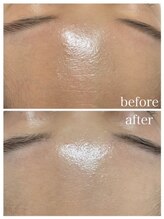 毛穴塾/無添加フェイシャルWAX脱毛