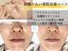 あらゆる肌悩みを改善【美肌改善コース】塗る針ピーリング¥14,500→¥11,000